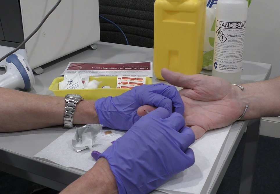 Close up of a hepatitis C point-of-care test in progress. Screenshot from video by Lisa Carter